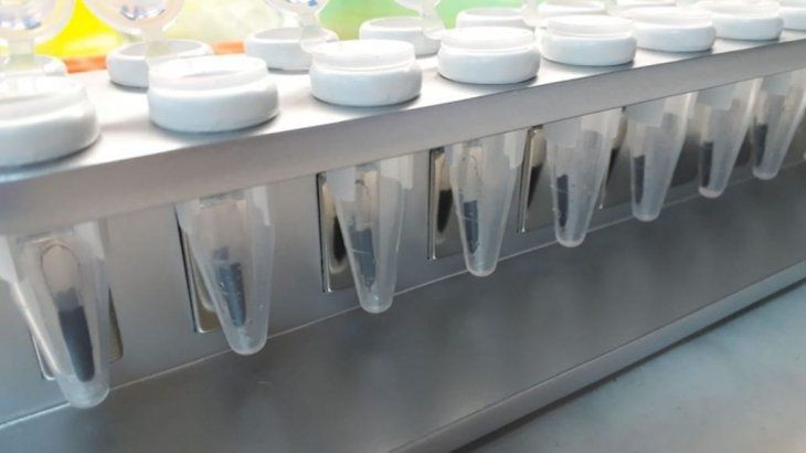 Coronavirus: científicos argentinos desarrollan un kit que acelera los testeos | Actualidad