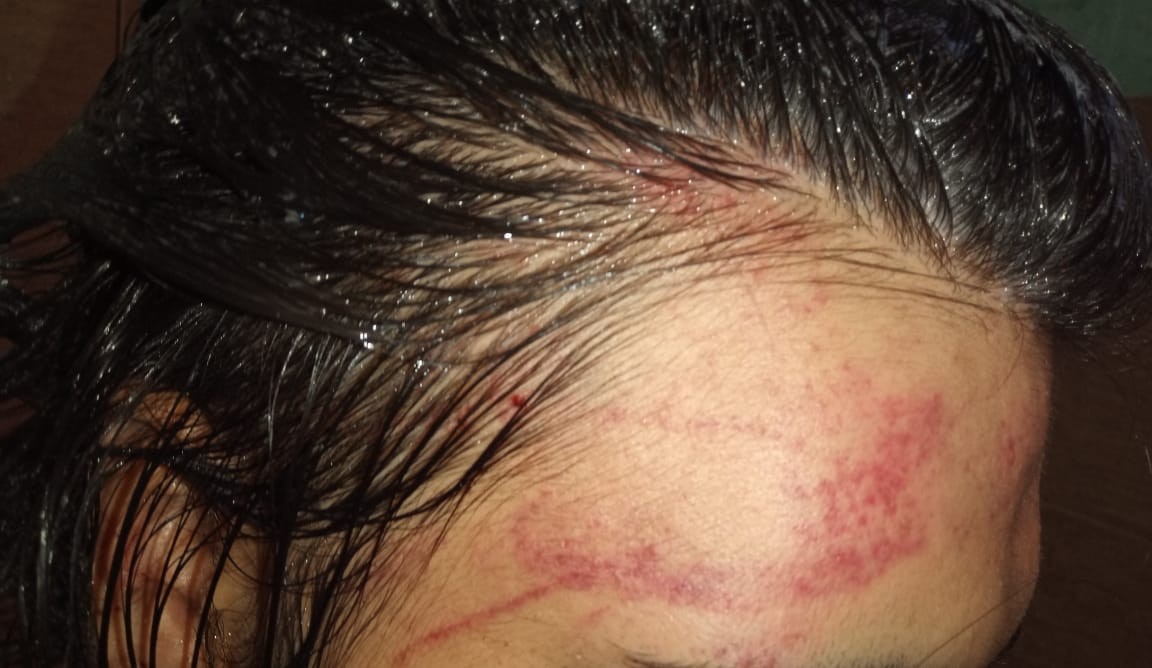 Golpiza de odio: atacaron en patota a trans de 16 años a la salida de una fiesta | Actualidad