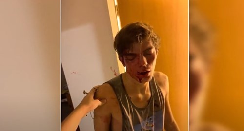 Eran conocidos, le robaron la llave y entraron a robar: su amigo fue desfigurado | Actualidad