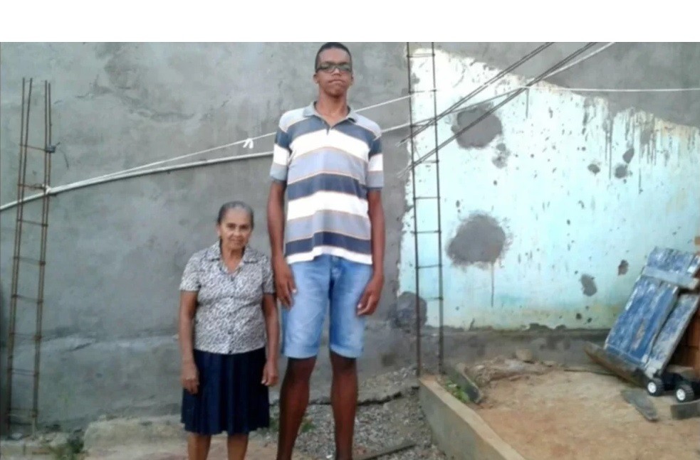 "No me gusta salir": el drama del joven de 22 años que mide 2,23 y sigue creciendo | Internacionales