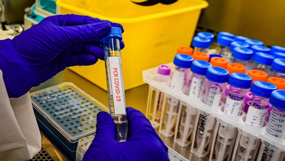 Coronavirus: identifican un caso de la cepa "doble mutante" en California | Internacionales