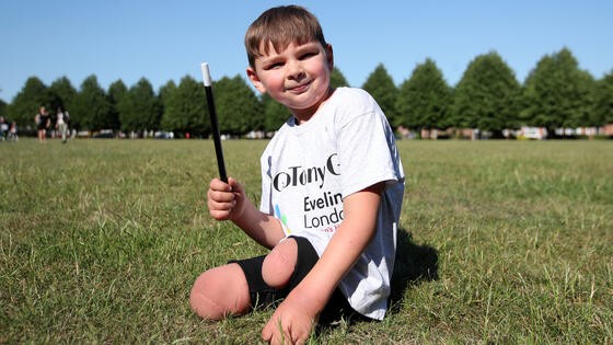 Un nene le amputaron las piernas por los abusos de sus padres y ahora logró caminar con prótesis | Internacionales