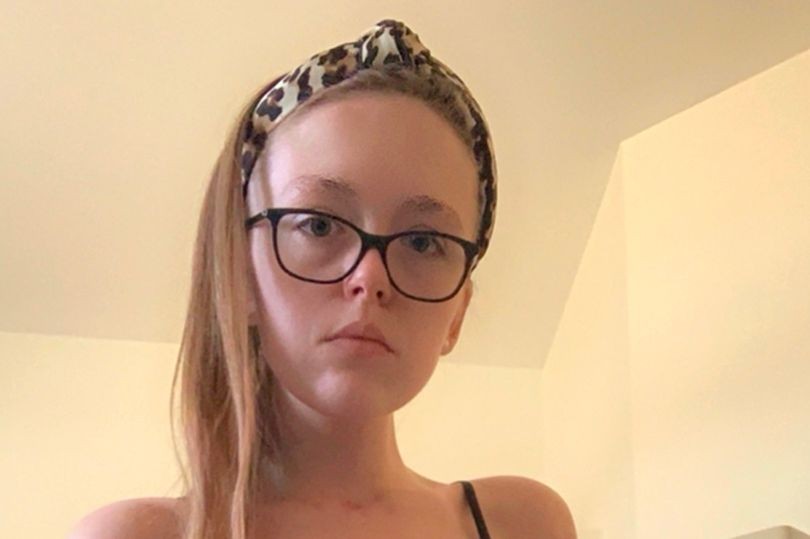 Tras una fiesta en un jacuzzi tuvieron que amputarle una pierna | Internacionales