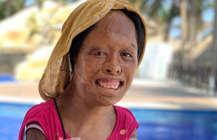 Su padre la quemó, la golpeó y la vendió: la niña dice que la Virgen de Guadalupe la salvó | Internacionales