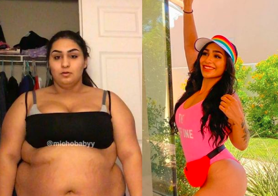 La increíble transformación de una joven con obesidad mórbida | Internacionales
