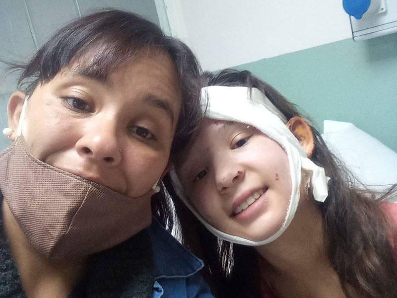 Conmovedor: volvió a nacer tras superar quemaduras, infección y hasta coronavirus | Actualidad