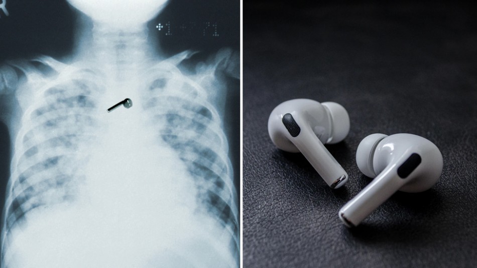 Se quedó dormido y se tragó uno de sus AirPods: los auriculares aún funcionan | Curiosidades