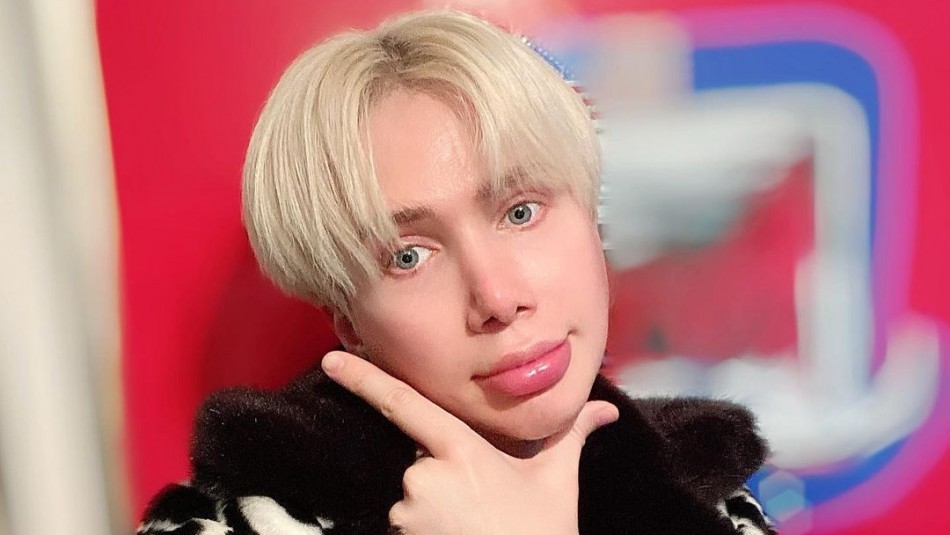 El influencer que se operó 18 veces para lucir como cantante de BTS: "Finalmente soy coreano" | Internacionales