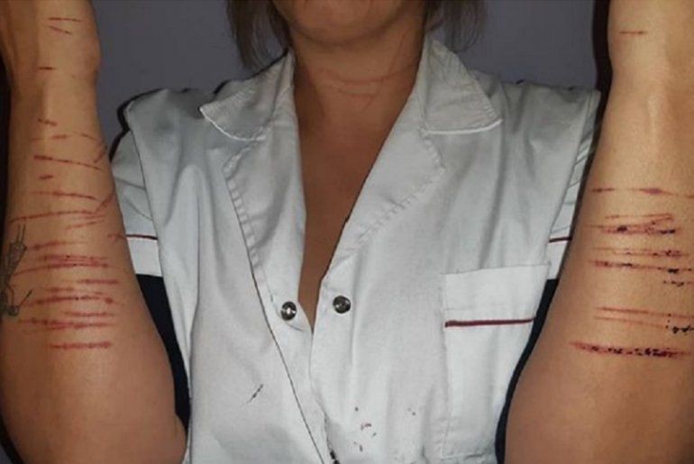 Un hombre se subió a un auto e intentó violar a la conductora: le cortó todo el cuerpo | Actualidad