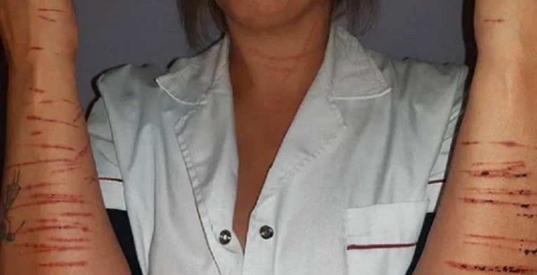 Brutal intento de violación: se resistió y el atacante le cortó todo el cuerpo | Actualidad