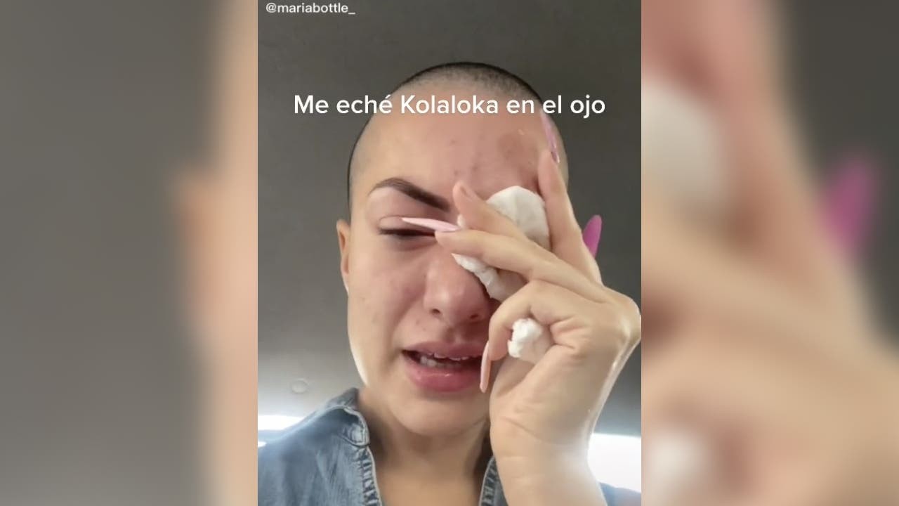 Video: el dramático relato de la influencer que confundió gotitas para los ojos con pegamento | Internacionales