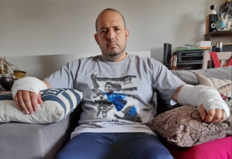 Feroz ataque de un pitbull en barrio Yapeyú | Córdoba