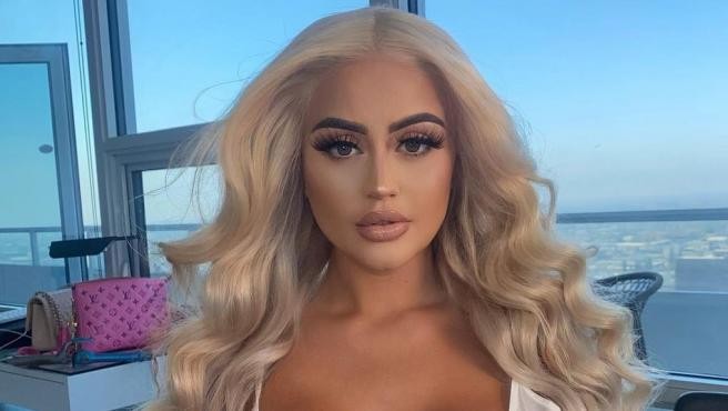 Una joven influencer terminó con los glúteos "arruinados" tras gastar 8.000 euros en inyecciones | Internacionales