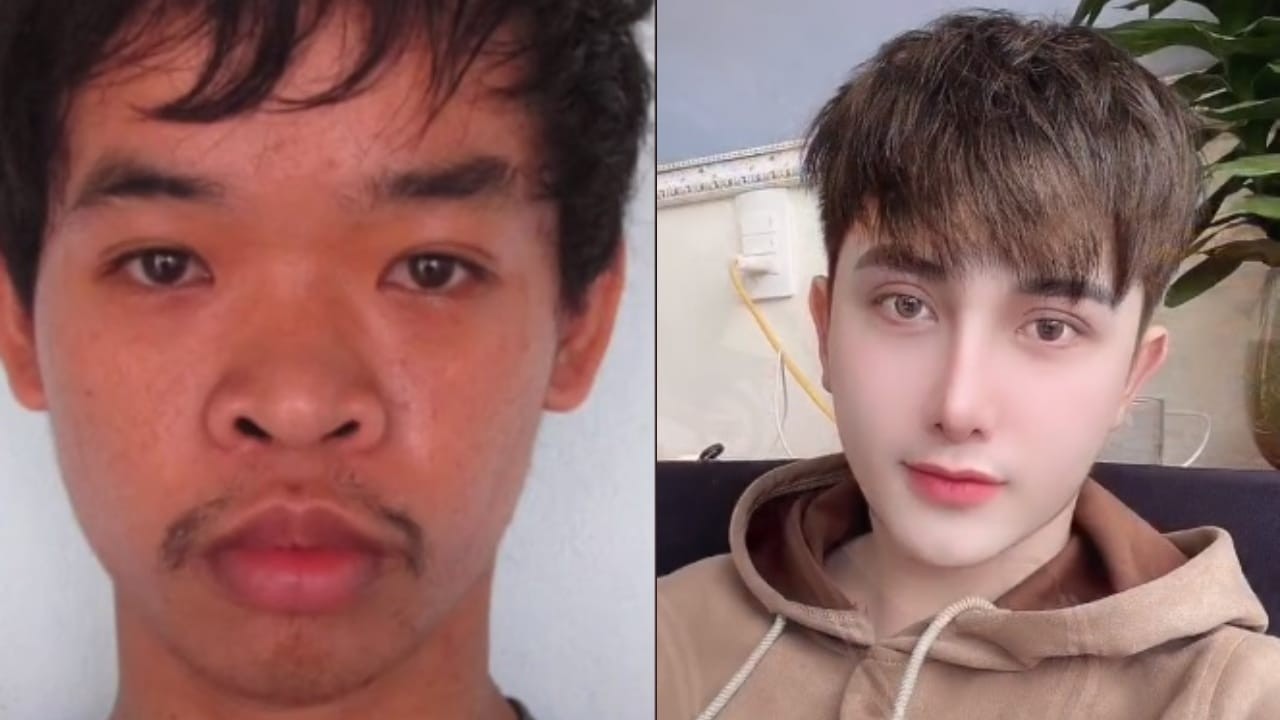 Lo rechazaron de un trabajo "por feo", se hizo 9 operaciones y ahora trabaja como modelo | Internacionales