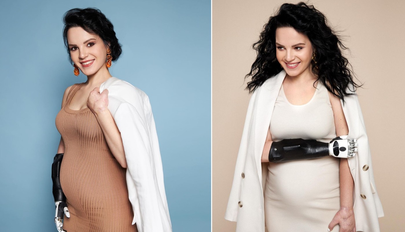 "Hoy me convertí en una madre-transformer": dio a luz la mujer a la que el marido le cortó las dos manos con un hacha | Internacionales