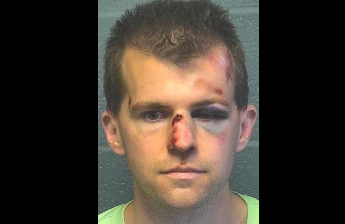 Sorprendió a un pastor religioso tocando a su hijo y le dio una brutal paliza | Internacionales