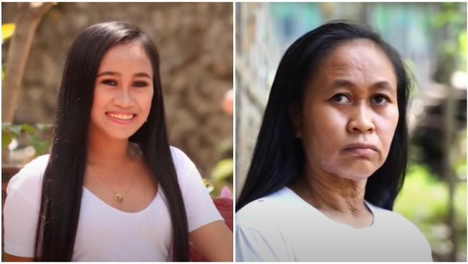 Un raro trastorno genético adelanta el envejecimiento de una chica: "Tengo 16 y parezco de 50 años" | Curiosidades