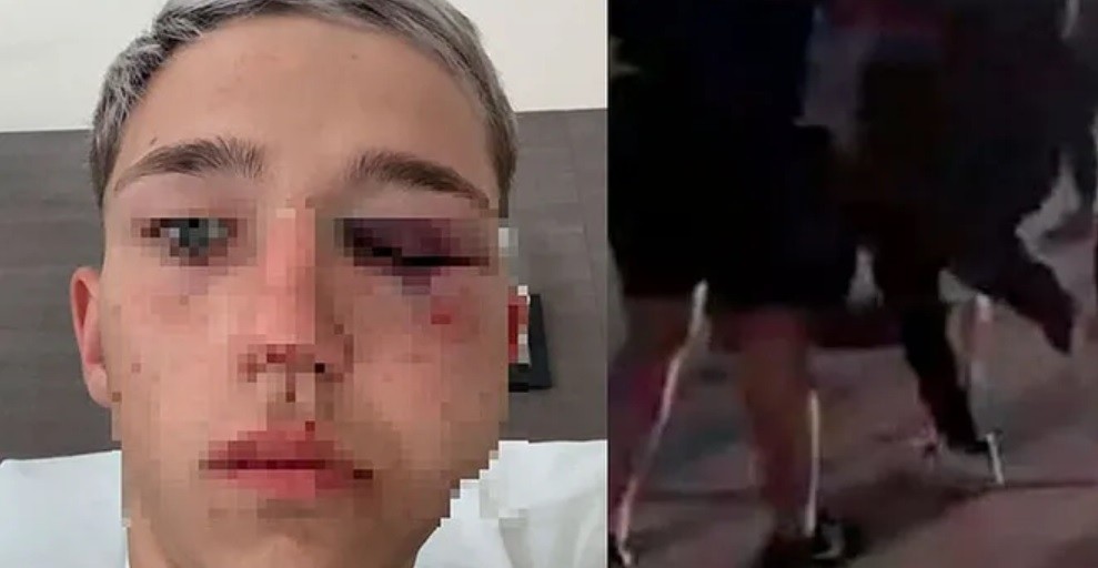 Imputan a cuatro rugbiers por la golpiza a un adolescente durante un cumpleaños en Mendoza | Actualidad