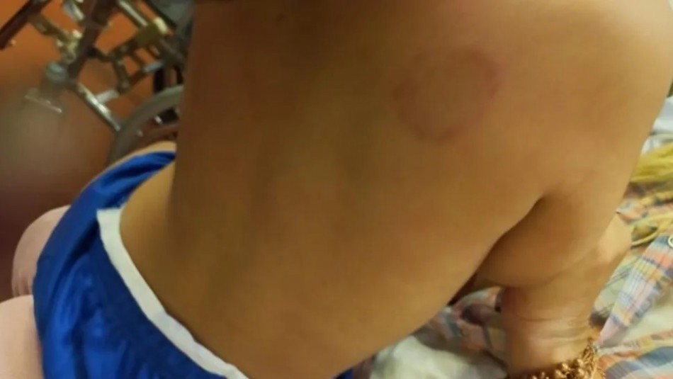 Una madre fue detenida por agredir a mordiscos a su hijo de 2 años: la denunció la abuela del menor | Actualidad