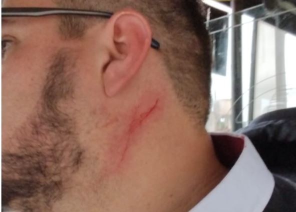 URGENTE: atacaron con un cuchillo a un chofer de la línea 73 | Córdoba