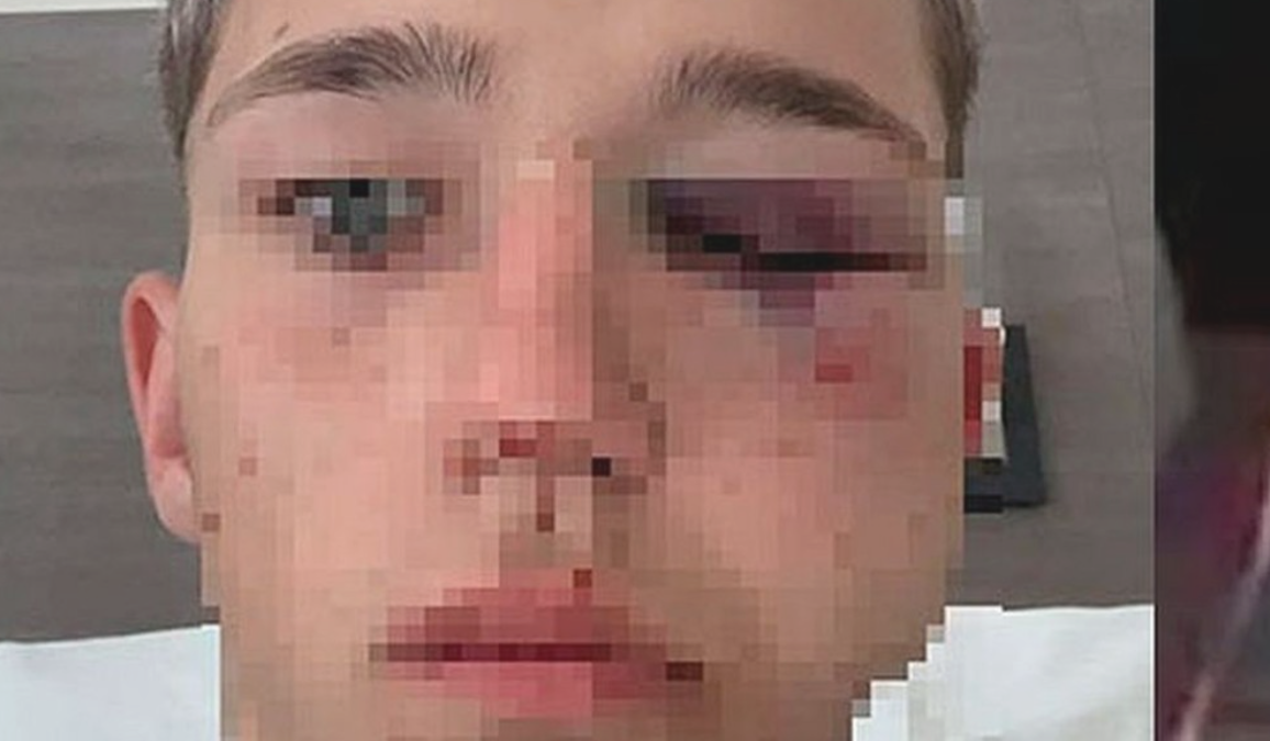 Imputarán a cuatro rugbiers en Salta por golpear a un adolescente en una fiesta | Actualidad