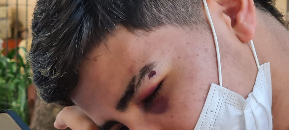 “Bebelo” Reynoso detenido: habló el adolescente agredido | Córdoba