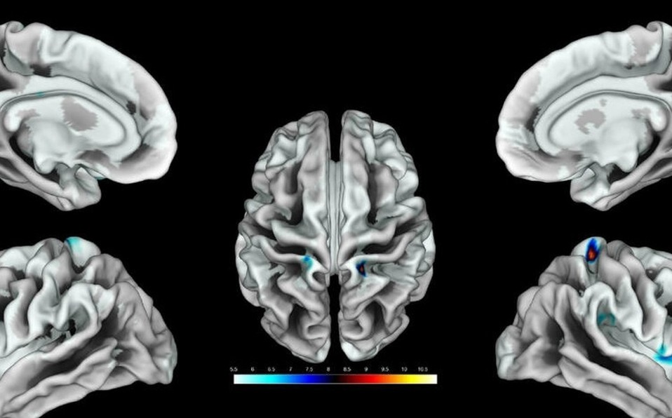 Fin del misterio: estudio científico identificó el área del cerebro que corresponde al clítoris | Internacionales