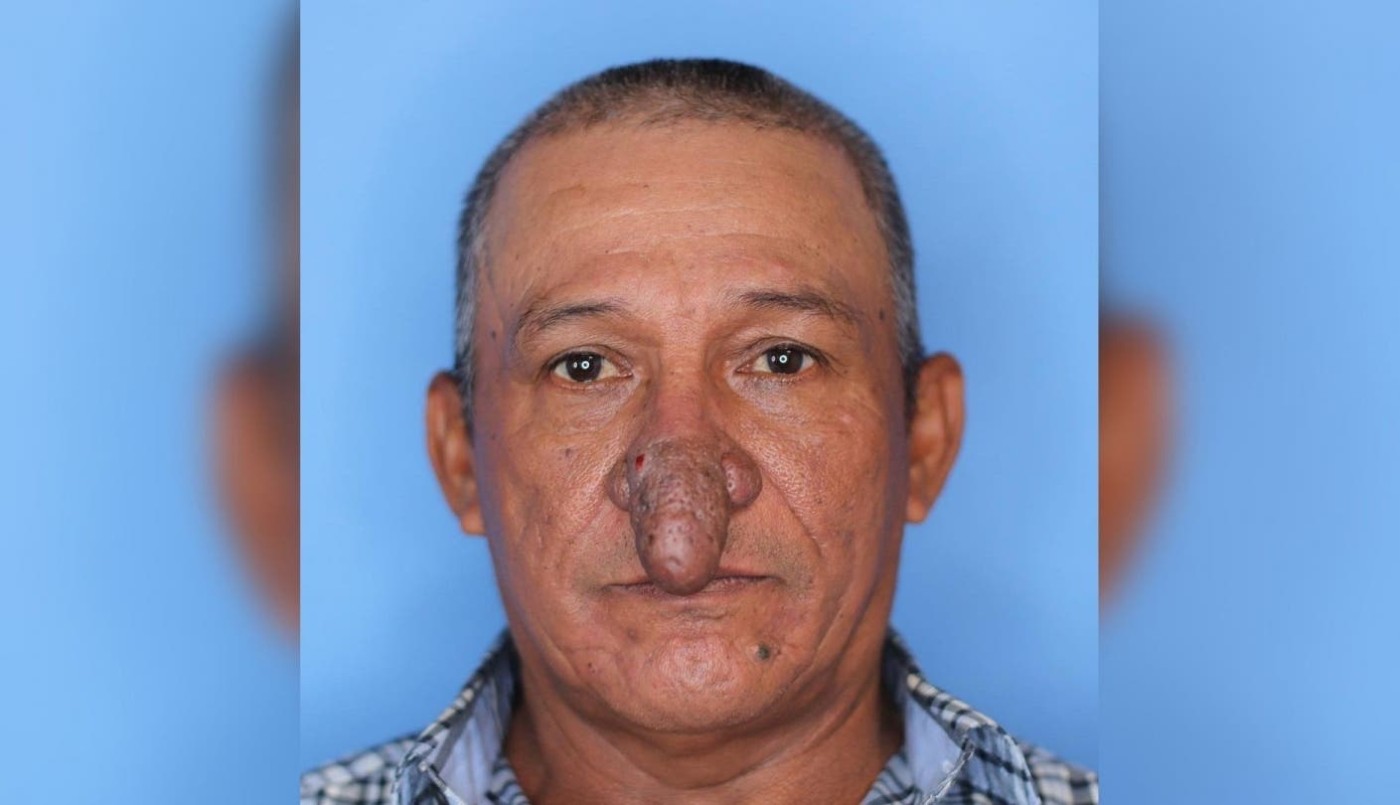 Vivía un calvario por la forma de su nariz hasta que el gesto de un cirujano cambió su vida | Internacionales