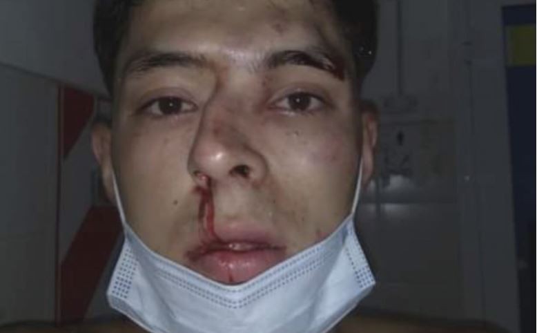 Chaco: Un estudiante de periodismo deportivo recibió una brutal paliza | Actualidad