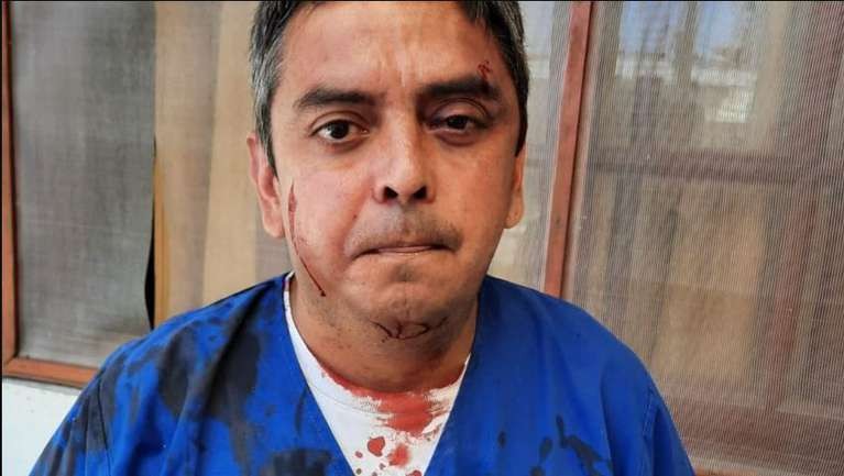 Acusó a un médico de haberlo contagiado de Covid y le dio una brutal golpiza | Actualidad