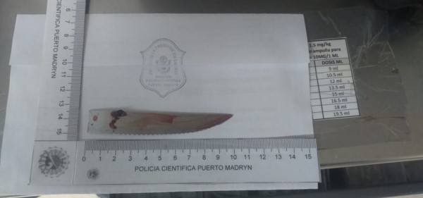 Milagro en Puerto Madryn: lo apuñalaron en el cráneo con un cuchillo de 10 centímetros y sobrevivió | Actualidad