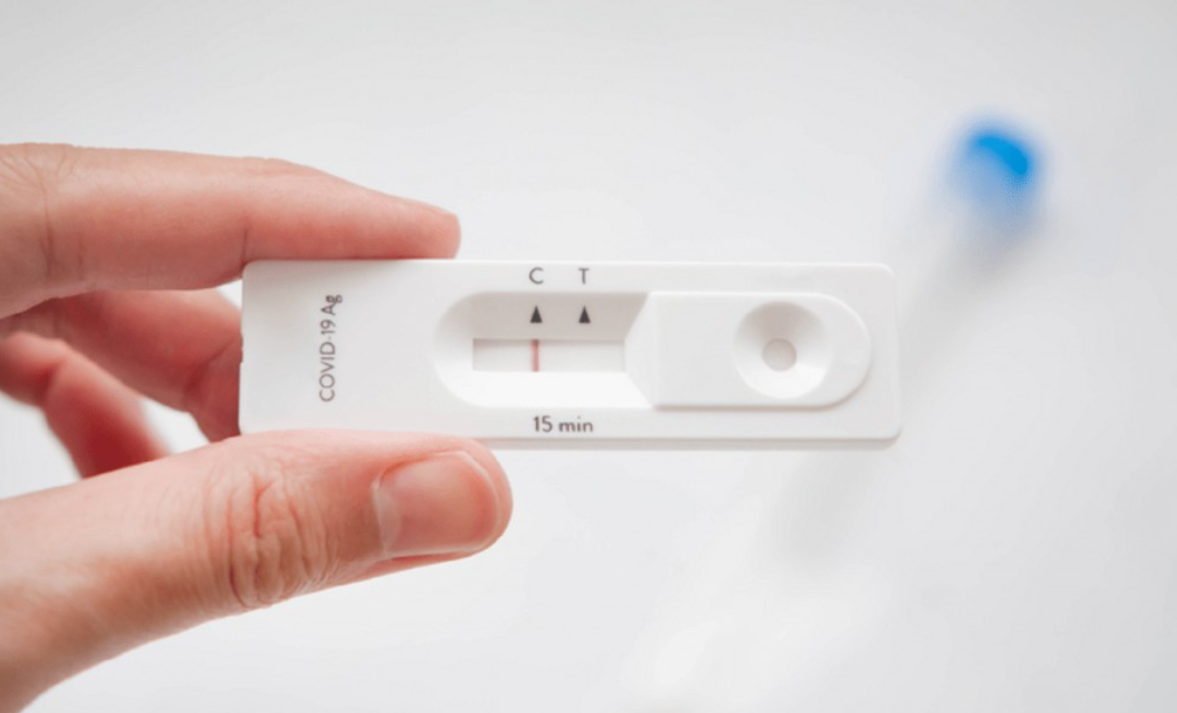 Autotest de Covid-19: estiman que la próxima semana todas las farmacias del país empezarán a venderlos | Actualidad