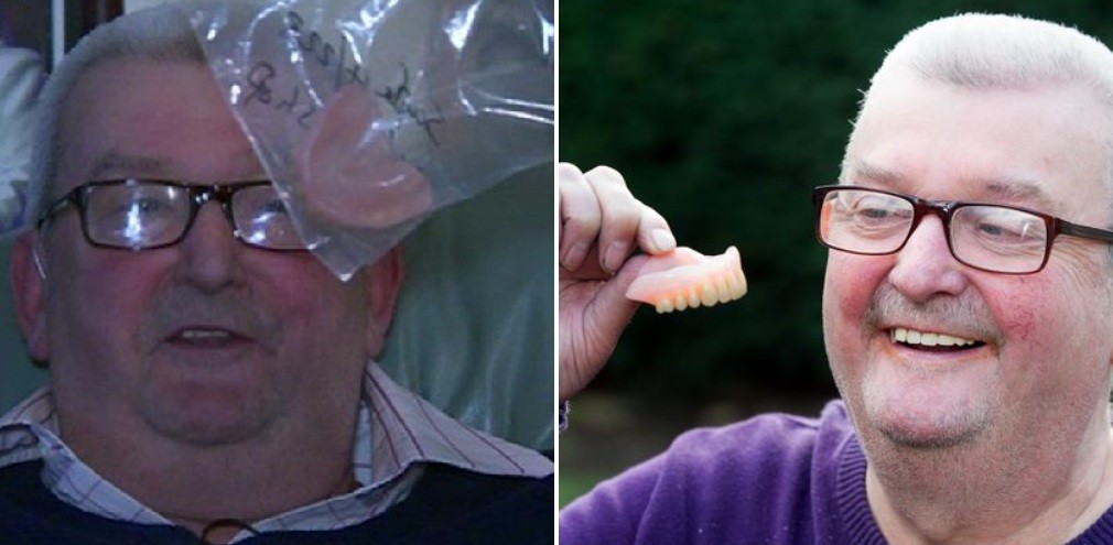 En una noche de borrachera perdió la dentadura postiza: se la devolvieron 11 años después por correo | Internacionales