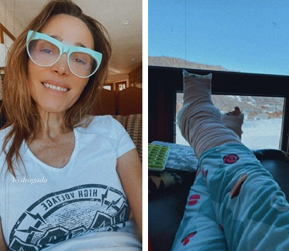 Las fotos de Vero Lozano luego de su accidente | Espectáculos