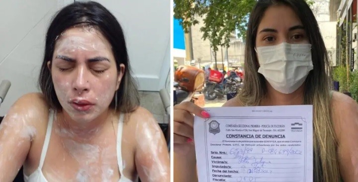 Una mujer acusó a otra de tocarle el espejo del auto, la persiguió y le tiró gas pimienta | Actualidad