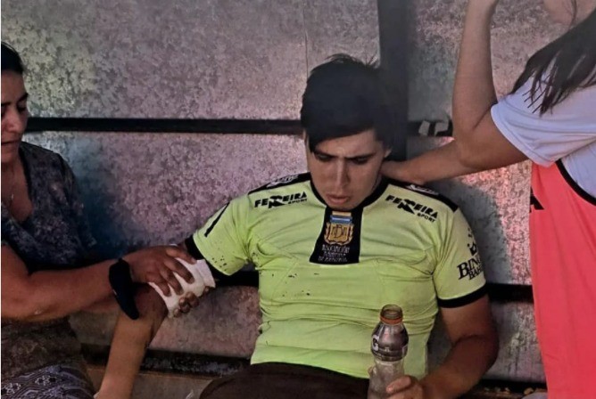 Lamentable: un árbitro asistente terminó en el hospital por la caída de una bengala en el fútbol femenino | Actualidad