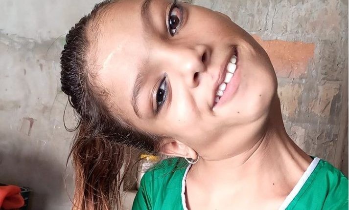 La “nueva vida” que tendrá una chica que estuvo 13 años con la cabeza en un ángulo de 90 grados | Curiosidades