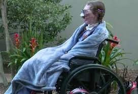 La historia de la chica que sobrevivió al feroz ataque de dos perros: le mordieron 800 veces la cara | Internacionales