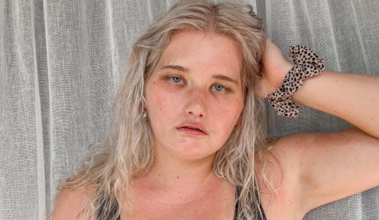 Sufre un extraño síndrome que no le permite sonreír y ahora trabaja de modelo | Internacionales