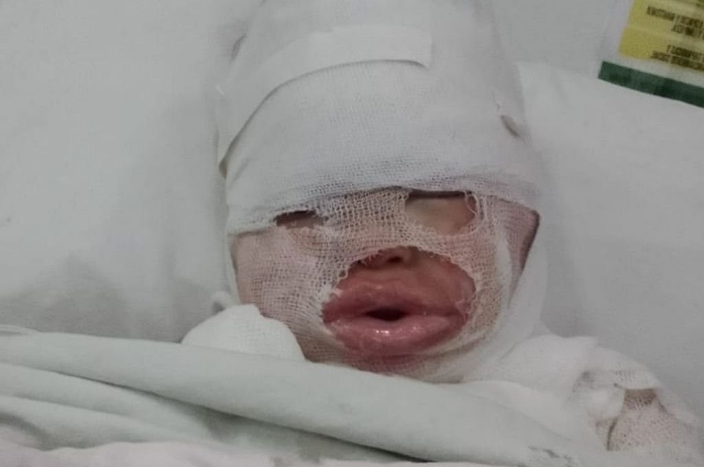 Habló la mamá de la nena de 3 años que sufrió quemaduras con aceite: "Quiero que la empleada dé la cara" | Actualidad