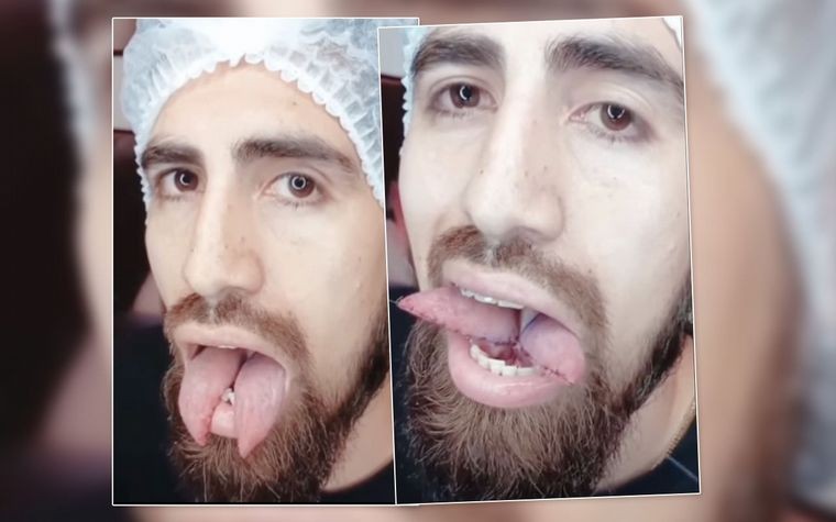 El ex jugador de Boca que se hizo una lengua bífida para parecer una serpiente | Curiosidades