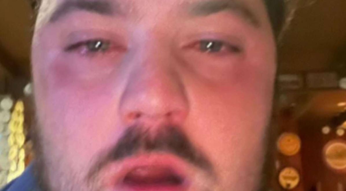 No estaba de acuerdo con los precio: atacó con gas pimienta al empleado de una cervecería y se fue sin pagar | Actualidad