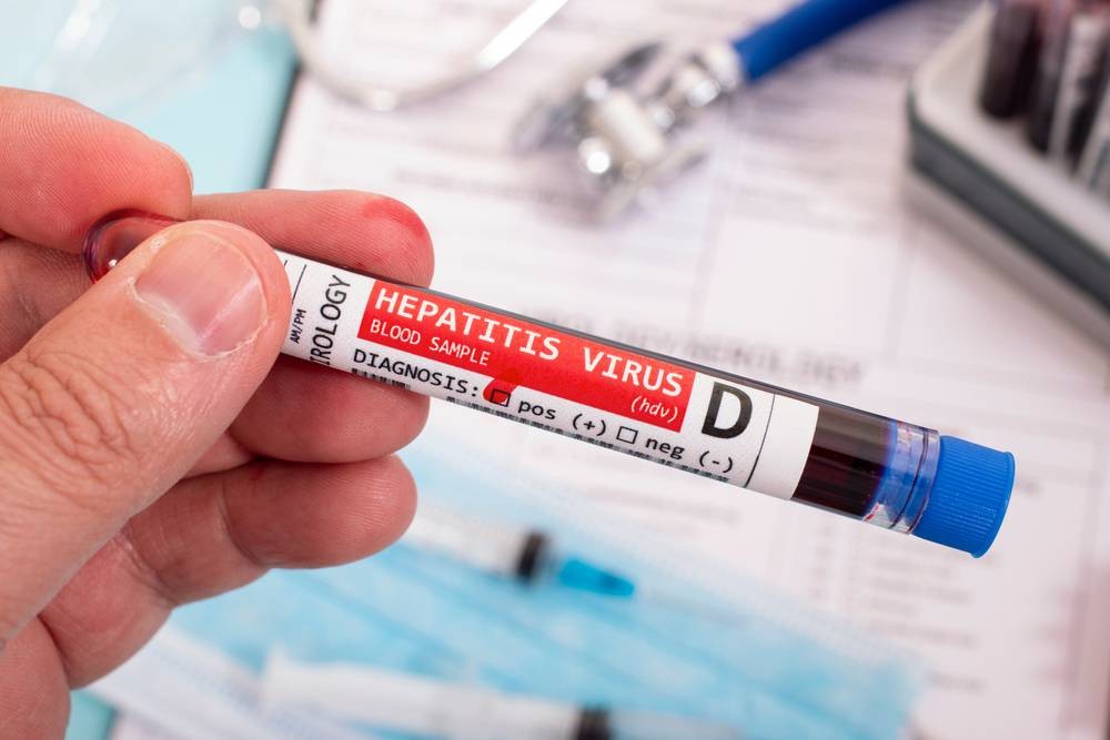 Murió el primer nene por la nueva hepatitis aguda de origen desconocido: cuáles son los síntomas | Internacionales