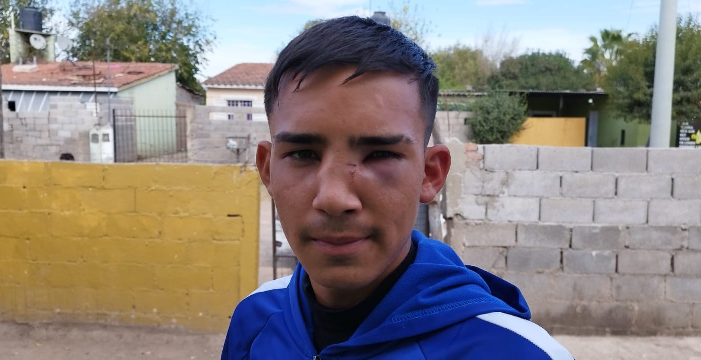 Batalla campal entre menores en la Liga de Punilla | Córdoba