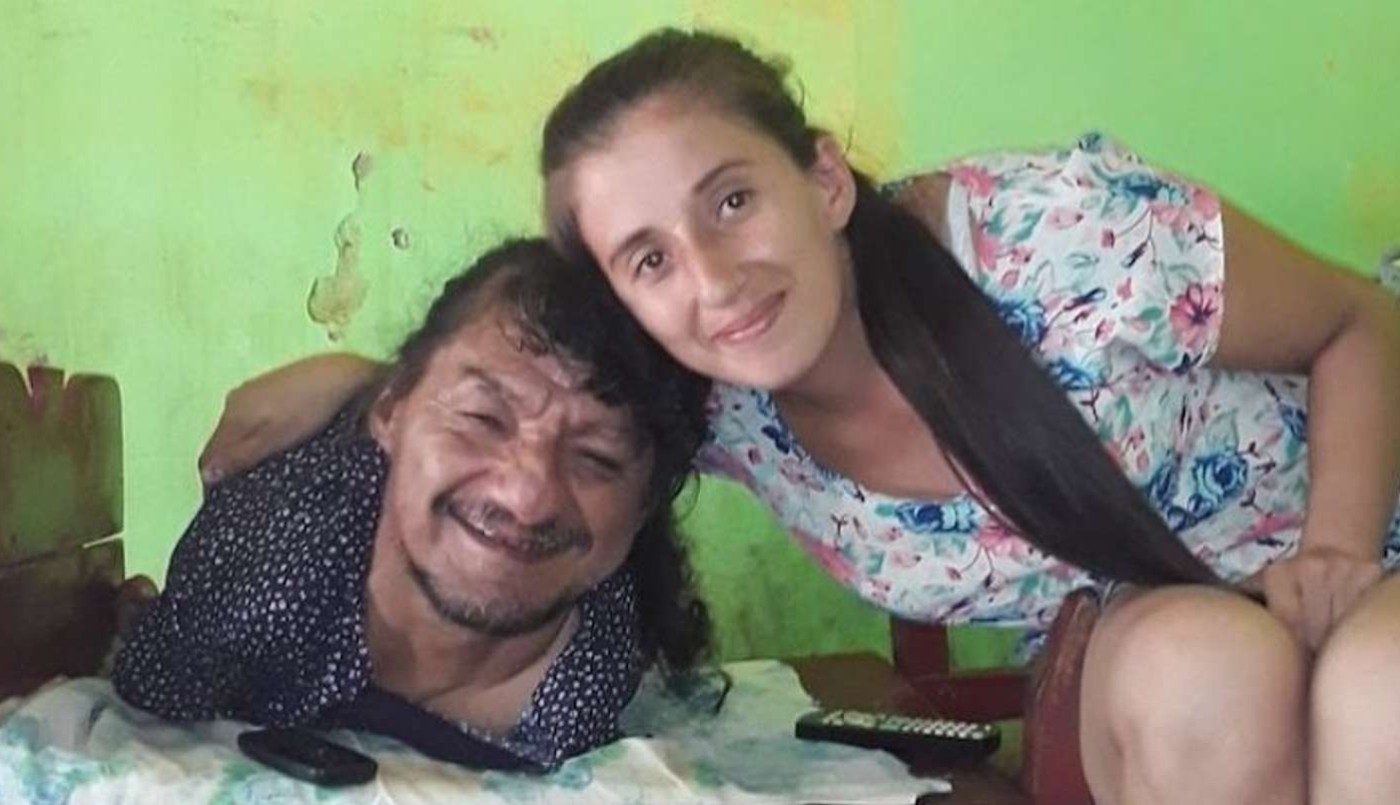 La conmovedora historia del hombre sin piernas ni brazos que crió solo a sus dos hijas | Actualidad