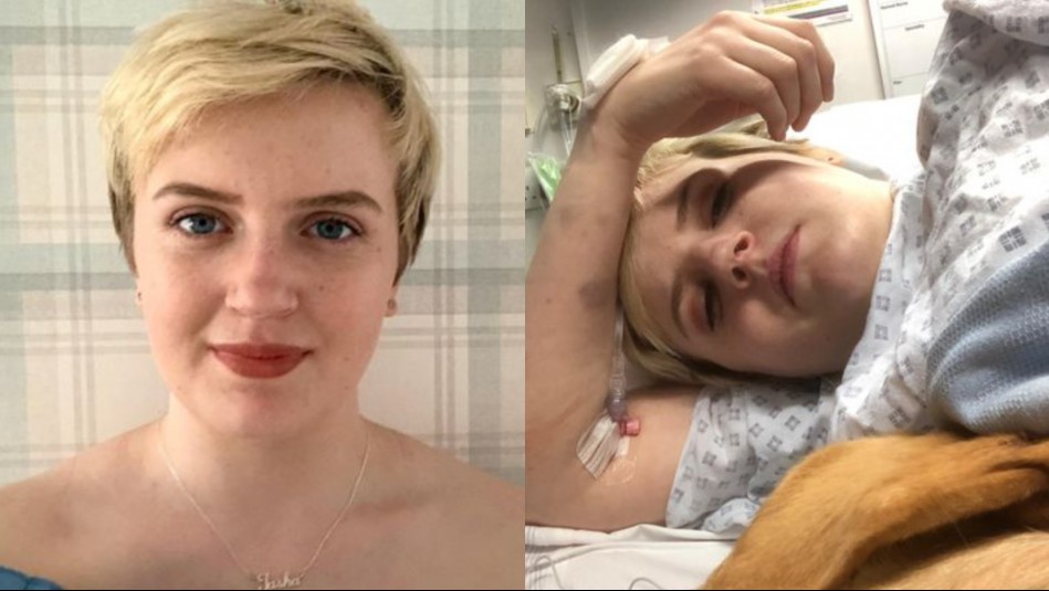 La joven que no puede ni reír ni llorar: "Soy alérgica a las emociones fuertes" | Internacionales