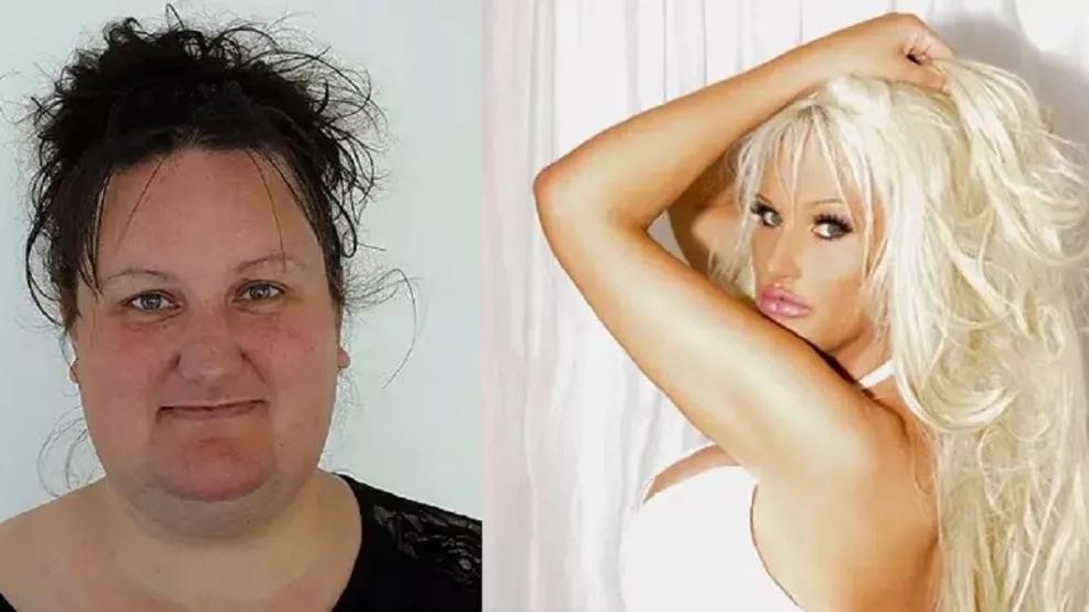 Bajó 90 kilos, se operó y ahora la confunden con Pamela Anderson: la foto de antes y después | Internacionales