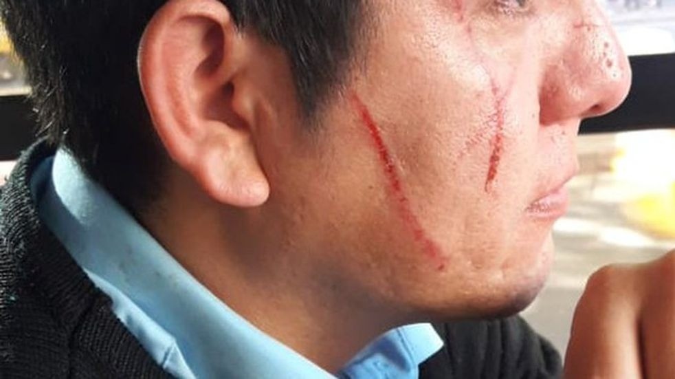 Violenta pelea entre un chofer de colectivo y una pasajera en Córdoba | Córdoba