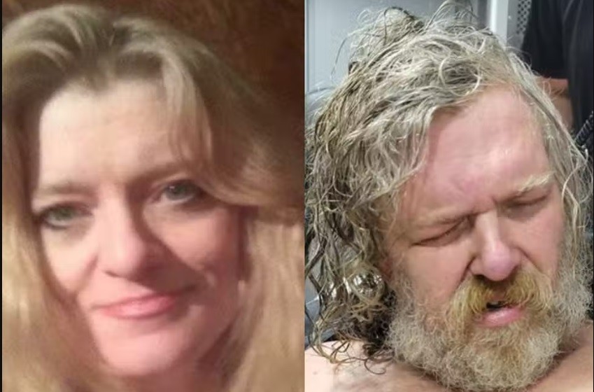 La atacaron con un machete y estuvo dos años en coma: al despertar, identificó a su hermano como el agresor | Internacionales