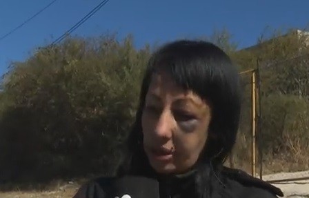 Dejó su casa por los golpes de su propio hermano | Córdoba